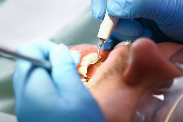 Best Broken or Cracked Tooth Emergency Dentist in Cascade Locks, OR