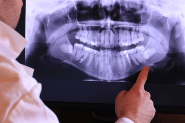Best Broken or Cracked Tooth Emergency Dentist in Cascade Locks, OR