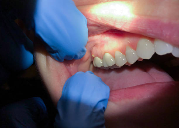 Best Pediatric Emergency Dentist in Cascade Locks, OR